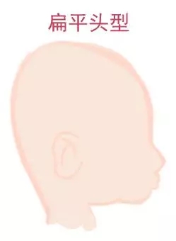 宝宝圆头好照旧扁头好？？？这些神秘许多爸妈都不知道4.webp.jpg